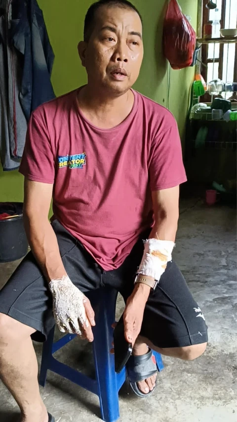 Jalan Tidak Ada Penerangan, Warga Teluk Mengkudu Menjadi Korban Sabetan Celurit Kawanan Begal