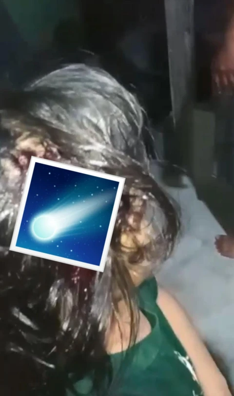 Tuding Polres Batu Bara Lamban, Pelaku Penganiayaan Anak Dibawah Umur Masih Belum Ditangkap