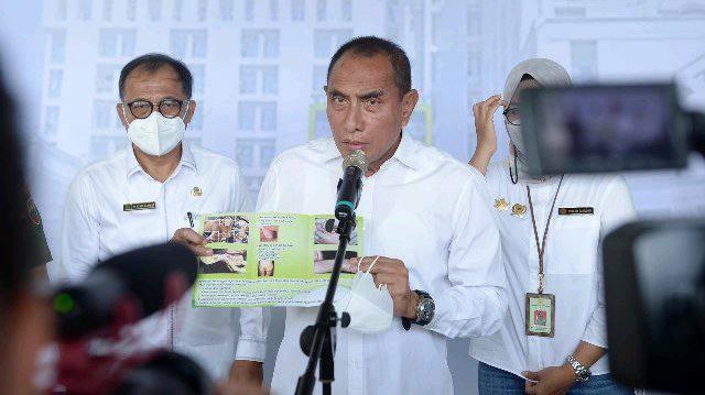 Kasus PMK Terkendali, Edy Rahmayadi Yakinkan Konsumsi Daging Aman
