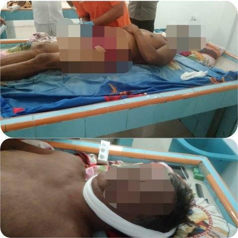 Buruh Panen Kebun Kwala Gunung Tewas Tertimpa Tandan Buah Kelapa Sawit
