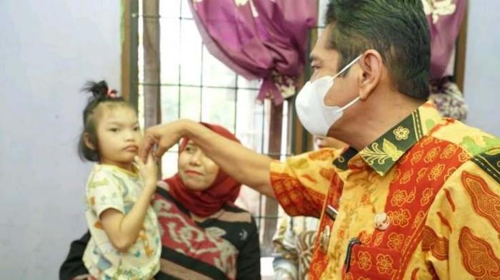 Pj. Wali Kota Tebing Tinggi kunjungi bocah penderita kelumpuhan saraf otak
